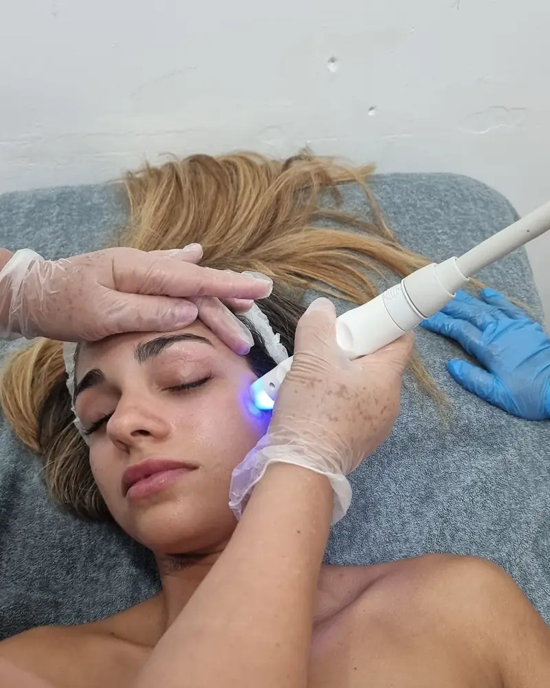 Estética
